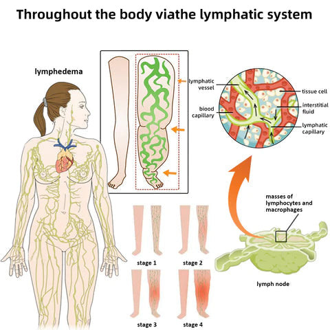 Bee Venom Lymphatic Daiamage & Sliming Patches (10 Patches)
