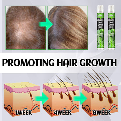 Ginger Plant Extract Anti-Hair Loss Hair Serum