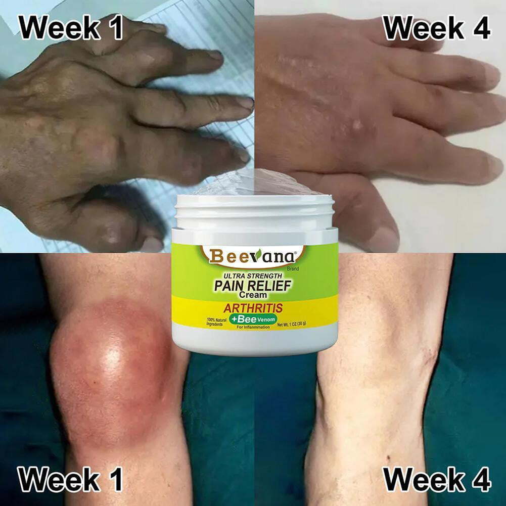 🐝 100% Original Bee Venom Cream - Buy 1 Get 2 Free 🔥