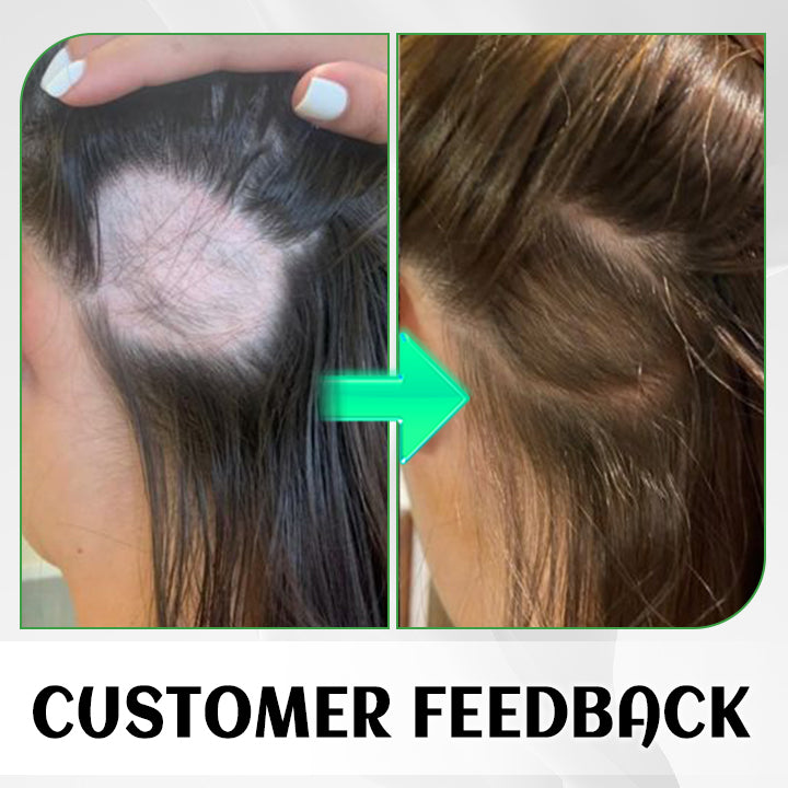Ginger Plant Extract Anti-Hair Loss Hair Serum