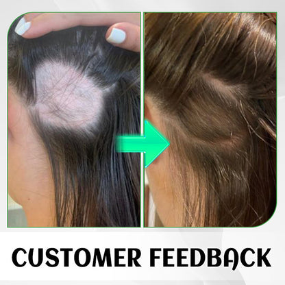 Ginger Plant Extract Anti-Hair Loss Hair Serum