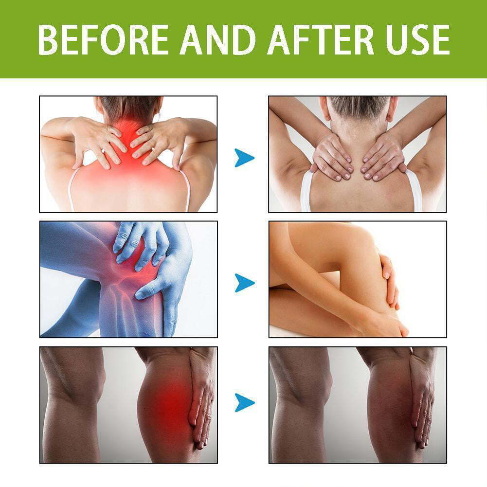 🐝 100% Original Bee Venom Cream - Buy 1 Get 2 Free 🔥