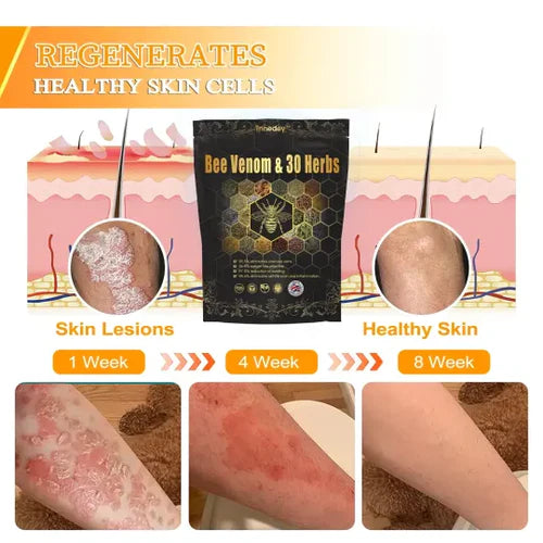 🐝 30 Herb Detox Foot Soak Beads for Body Sculpting  🔥 Buy 1 Get 1 Free 🐝
